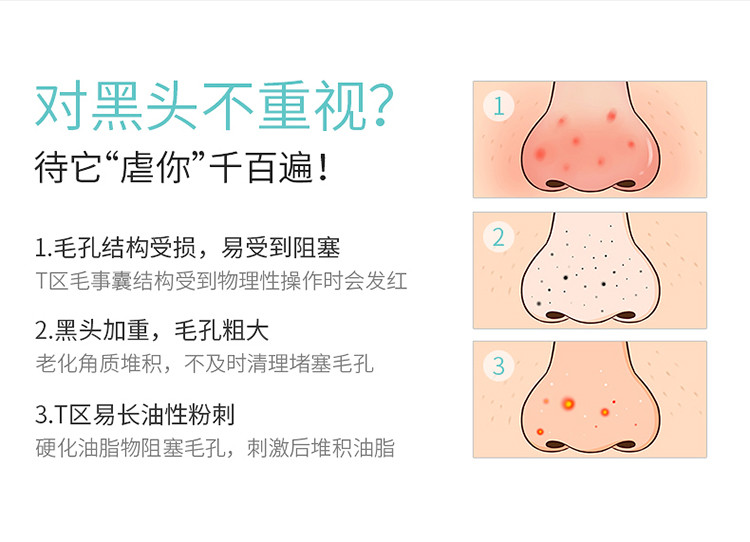 玛贝拉去黑头三合一鼻贴