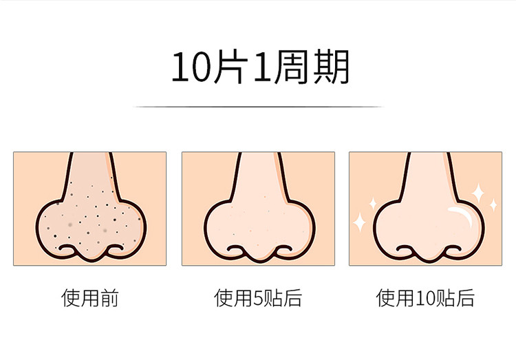 玛贝拉去黑头三合一鼻贴