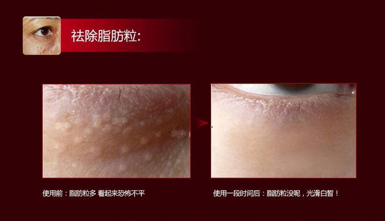 it s skin伊思红参蜗牛滚珠眼霜 淡化细纹黑眼圈紧致肌肤