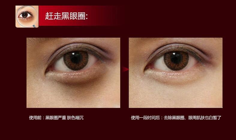 it s skin伊思红参蜗牛滚珠眼霜 淡化细纹黑眼圈紧致肌肤