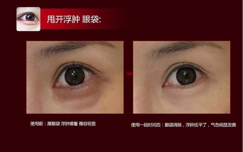 it s skin伊思红参蜗牛滚珠眼霜 淡化细纹黑眼圈紧致肌肤