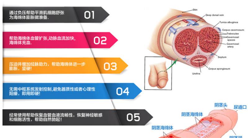 取悦延时真空助勃器起勃器增大器 男用jj自慰飞机杯 成人情趣性用品 小号助勃器