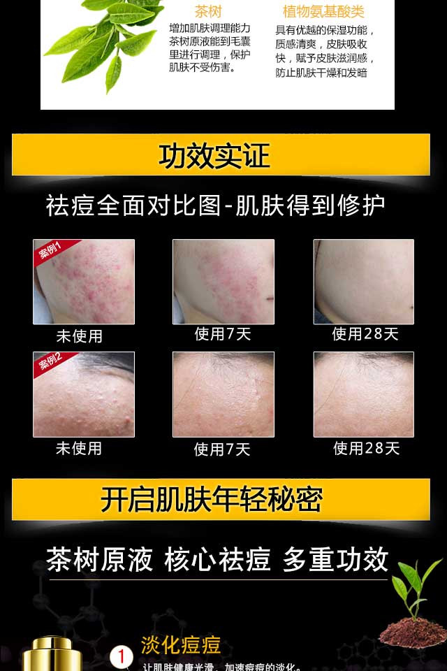 【邮乐濮阳】TQ梵西茶树原液男女祛痘印精华液正品 30ml