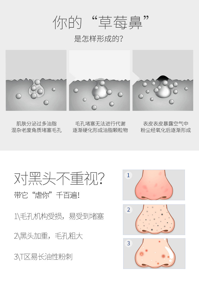 【领券立减】美克斯(MKS) 美容仪吸黑头去黑头吸出器毛孔清洁器电动黑头仪NV8530