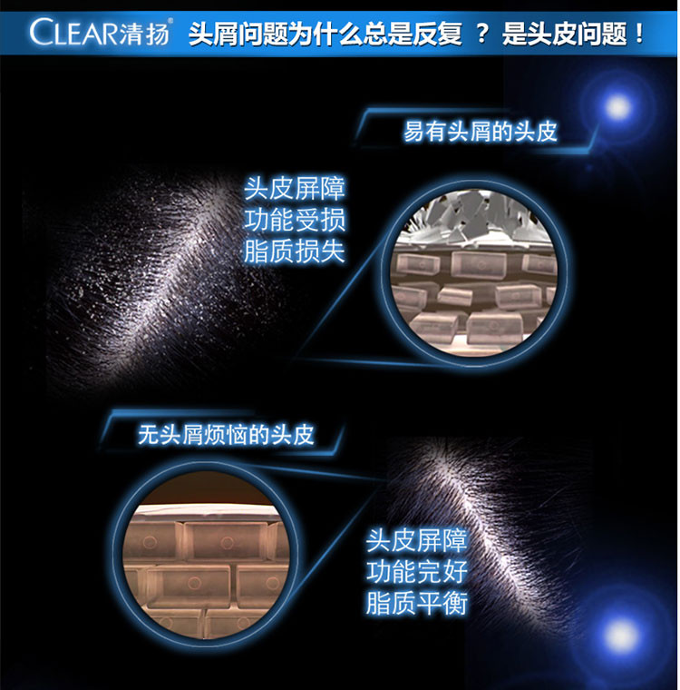 清扬洗发水750ml清爽控油型洗发露乳去油去屑止痒洗头膏家庭装