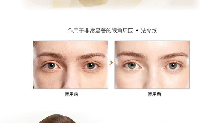 Spa treatment蛇毒眼膜去黑眼圈去细纹 60枚