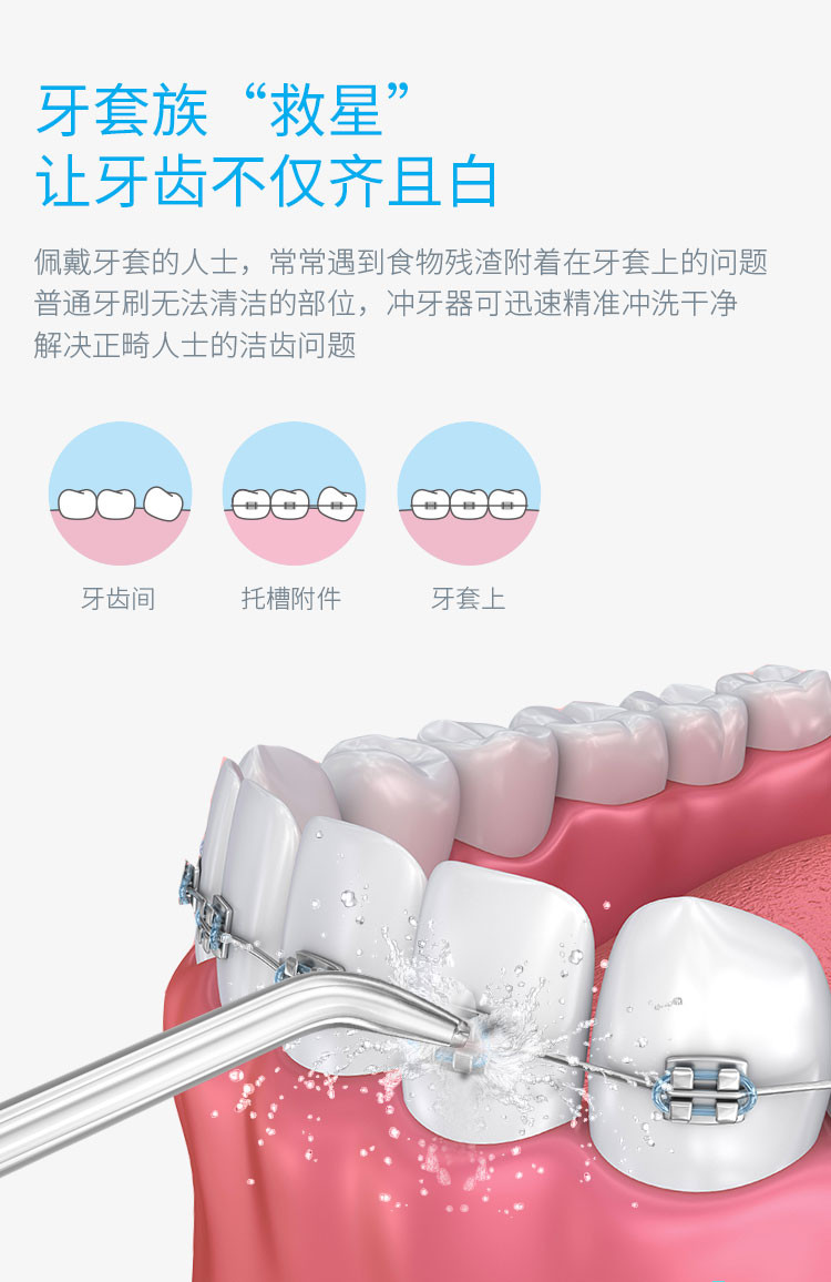 安卫小蛮腰（xwaves）冲牙器外出家用口腔正畸牙去结石水牙线便携式电动洗牙器 洁净白TI0010