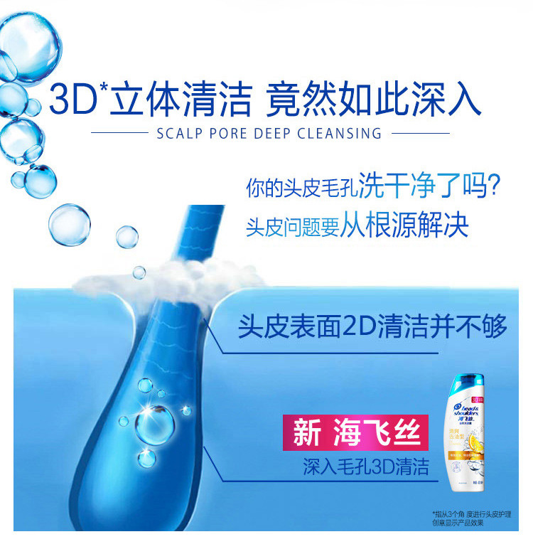 海飞丝去屑洗发水清爽去油型男士女士通用400ml*4支（新旧包装随机发）