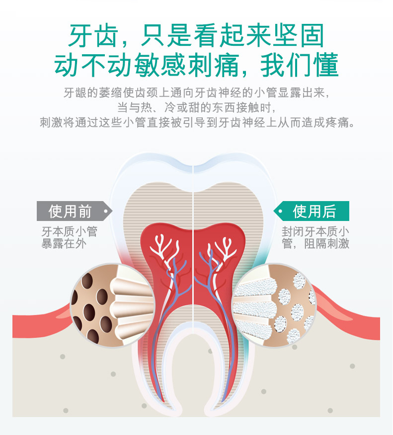 【上党馆】隆力奇生物酶牙膏90g送牙刷 家庭装去口臭美白口气清新 包邮（偏远地区除外）