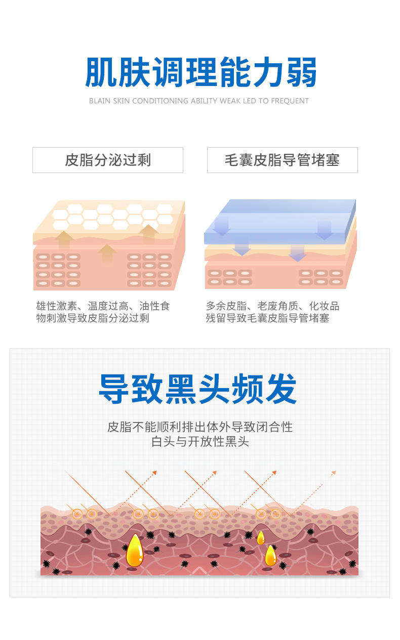 WIS去黑头粉刺收缩毛孔导出液男女适用鼻贴膜 功效祛黑头终结套装