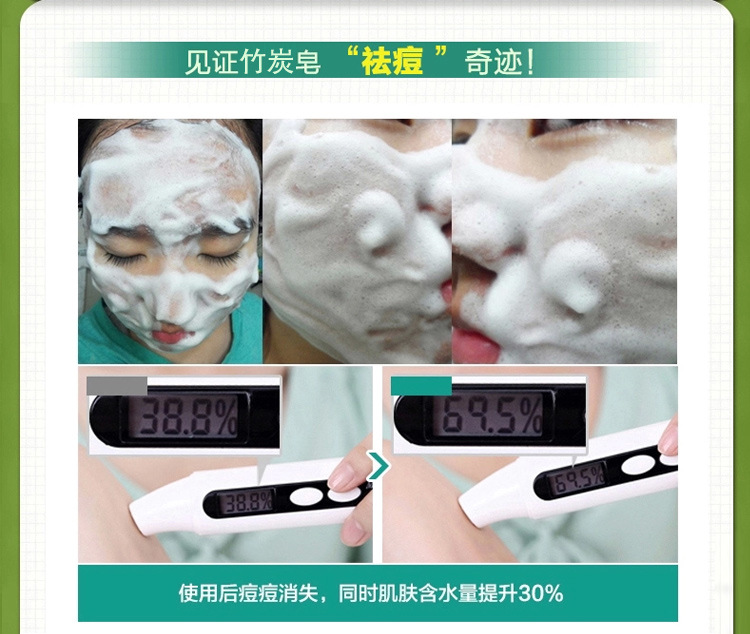 KD 竹炭手工皂 去黑头 美白 除痘 清爽控油80g竹炭手工皂