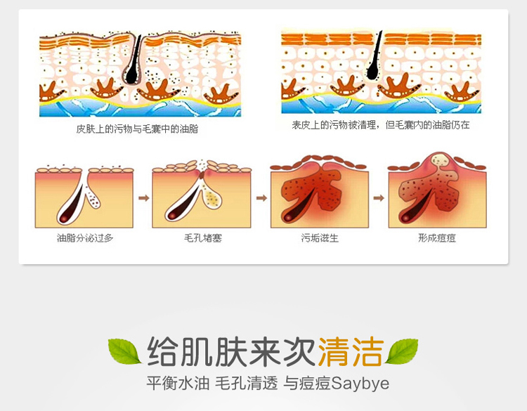 包邮 相宜本草控油祛痘洁面膏100g控油