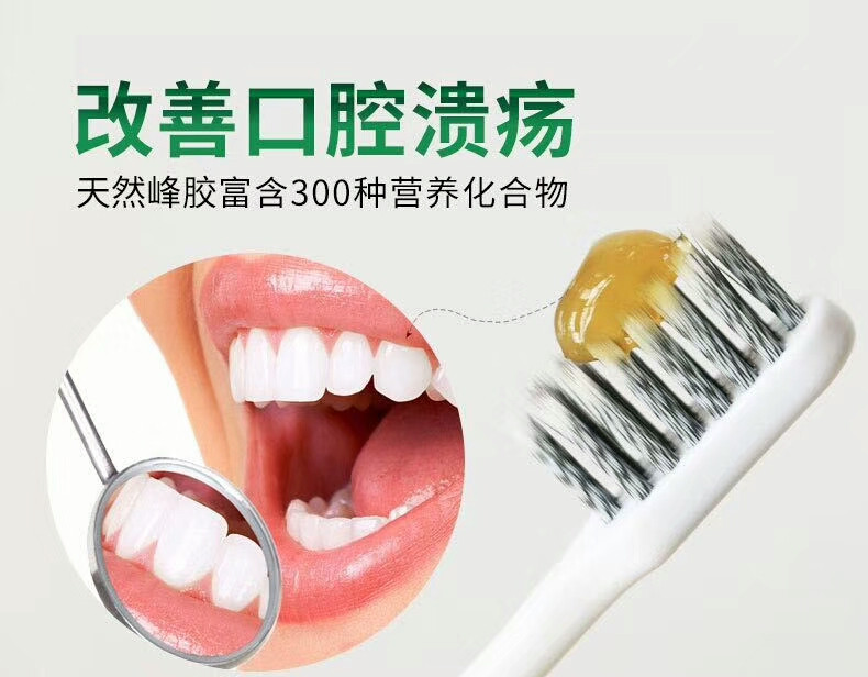 阿纯蜂胶植物牙膏正品牌子专柜120g牙龈出血口干上火祛除口腔异味