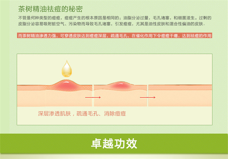 英国AA网精油茶树精油10ml单方精油