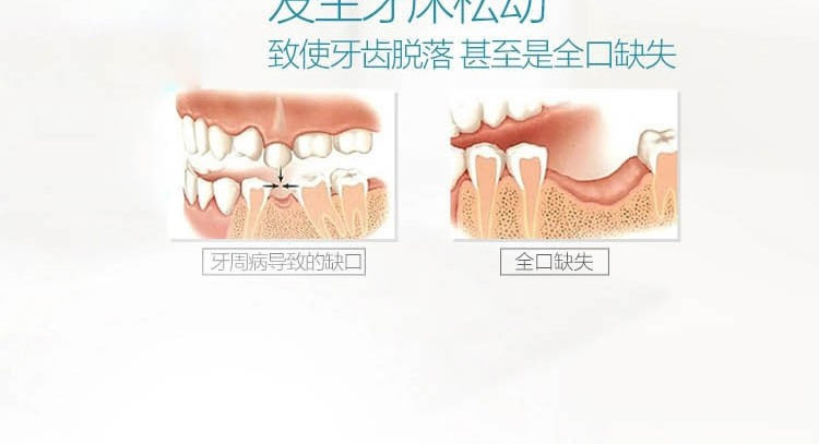 飞利浦/PHILIPS成人充电式电动牙刷 声波自动式牙刷 防水式 智能设计 HX6631/01