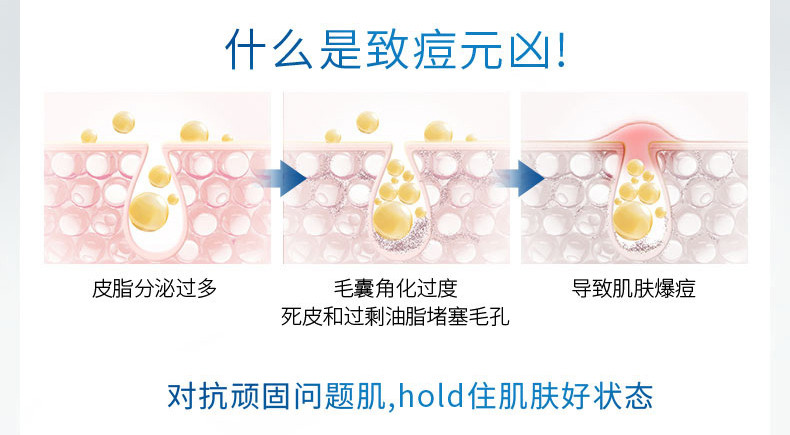 舒肤佳排浊沐浴露痘肌洁护540ml自选温和深层清洁滋润清爽男女士家庭用沐浴乳液