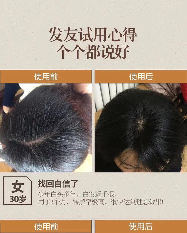 【滋养出黑发】99%转黑何.首乌洗发水少年中年白发变黑洗发水300ml