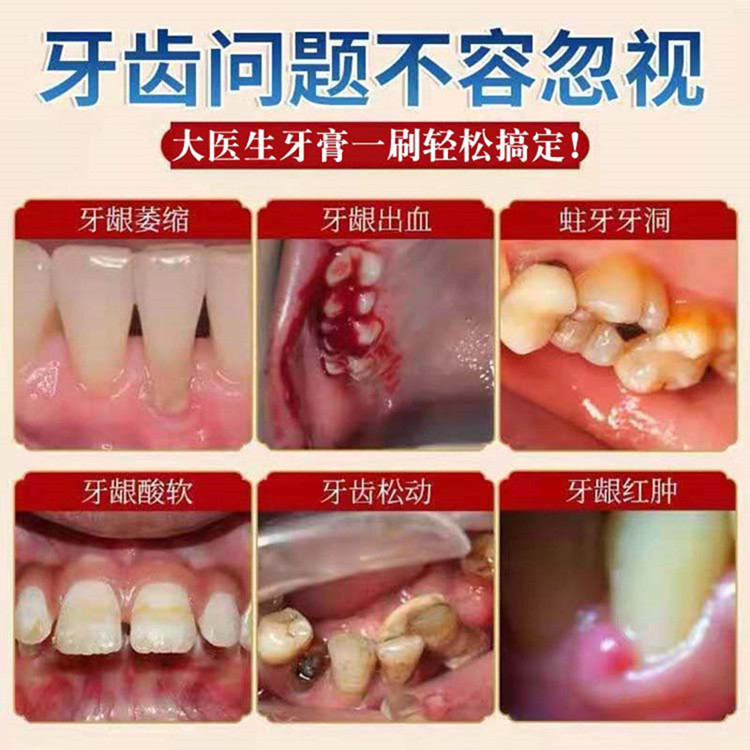 【正品大医生止血止痛强功效】洁白健齿防蛀牙膏龋齿修复去黄去口臭牙龈出血牙痛抗敏亮白