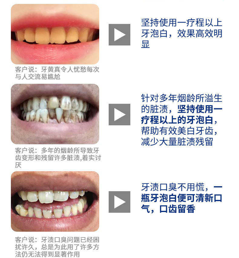 【一瓶抵五瓶洗牙粉】不白退全款美白牙齿清新口气脱色剂牙泡白