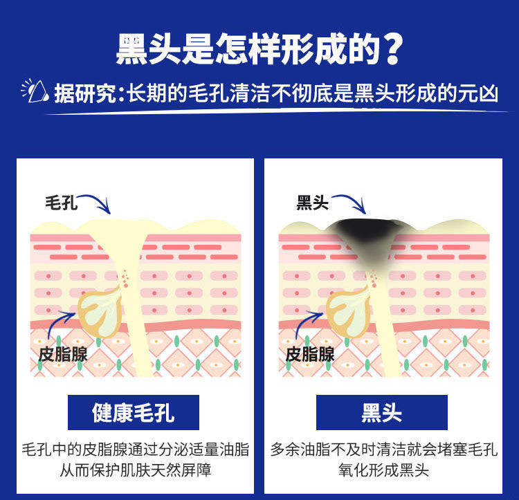 【专柜正品】改善多余油脂分泌 科颜氏亚马逊白泥面膜14ml 深层清洁去黑头粉刺