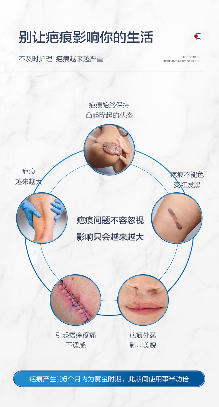 欧泉琳 成人手术剖腹产去疤膏除疤双眼皮祛疤贴美国巴克疤博士美皮护祛疤