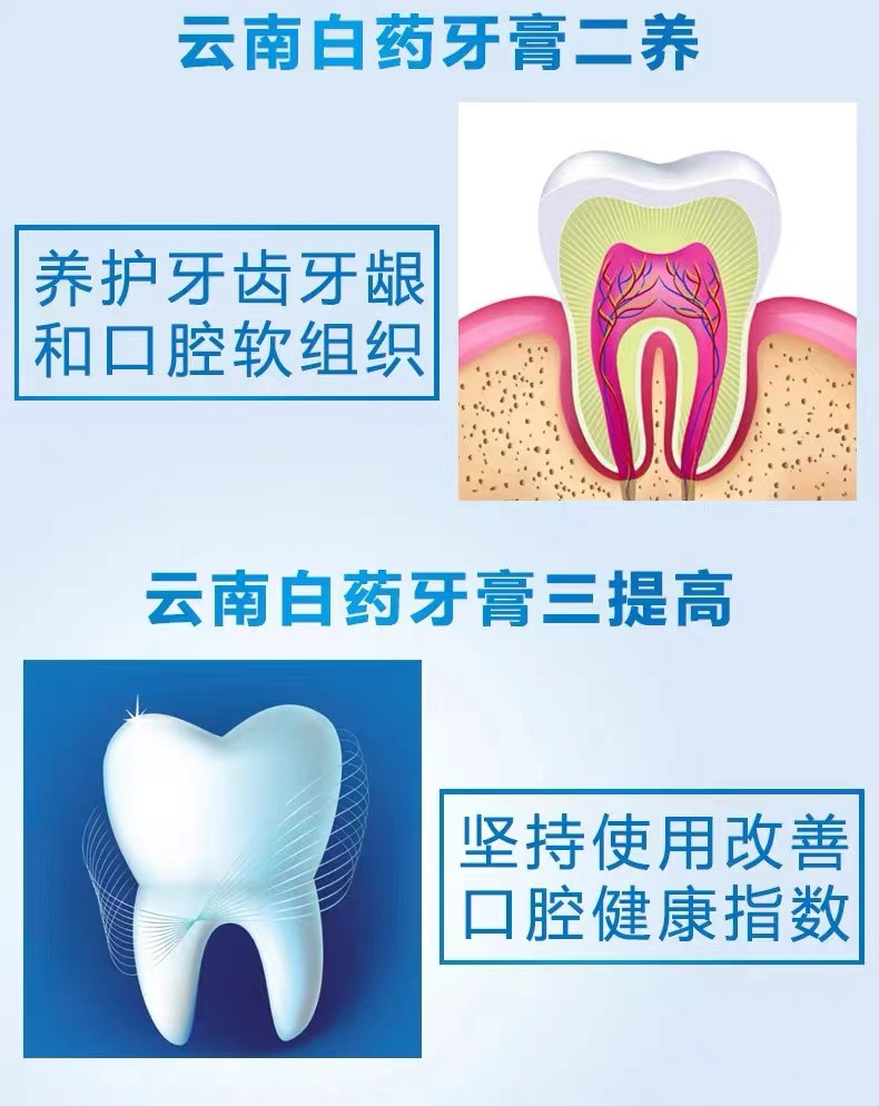 云南白药 天然美白冬青香型牙膏 165g 减轻牙龈出血肿痛