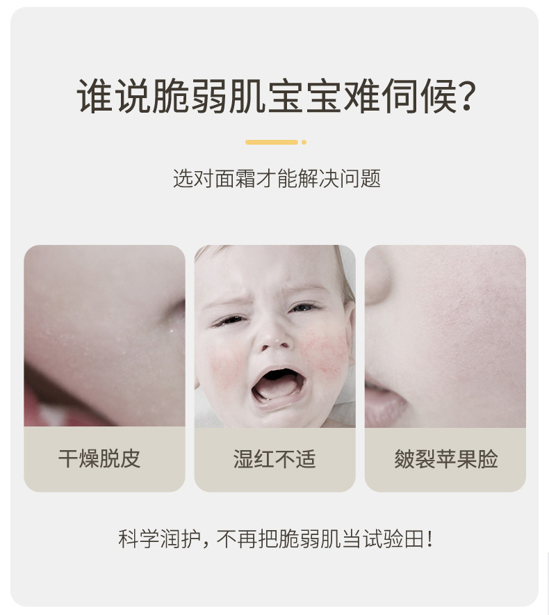 袋鼠妈妈婴儿舒润倍护霜（50g）新生婴儿专用润肤舒缓滋润儿童霜