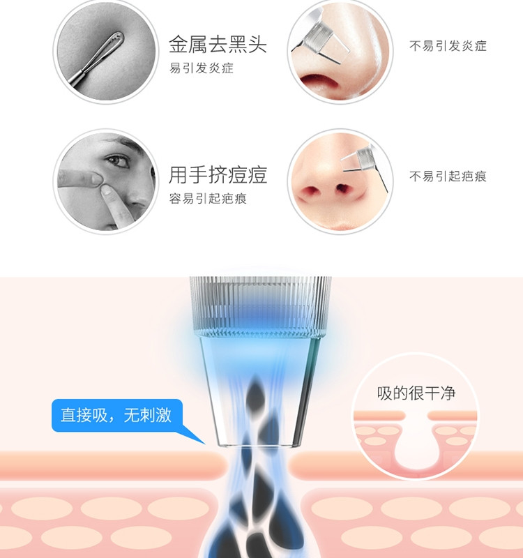 美克斯（MKS）吸黑头神器 微晶黑头仪 家用电动去黑头仪器去粉刺油脂污垢脸部清洁仪 NV8530