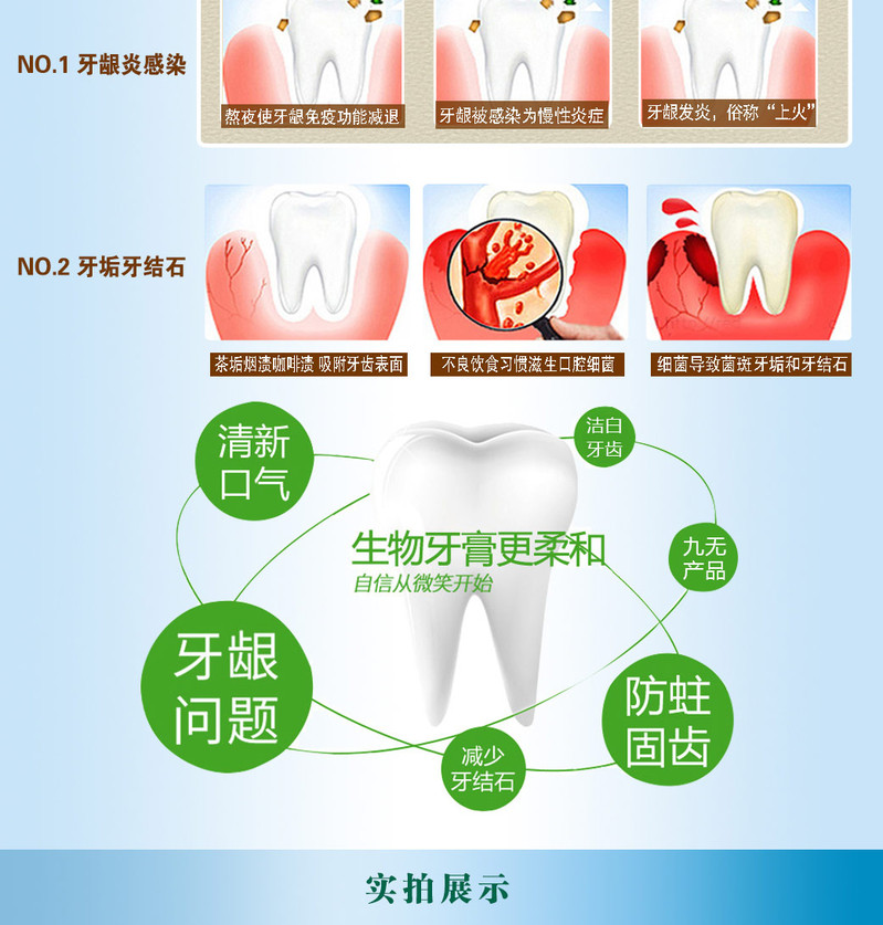 fe生物牙膏生物溶菌酶功效型牙膏90g赠牙刷
