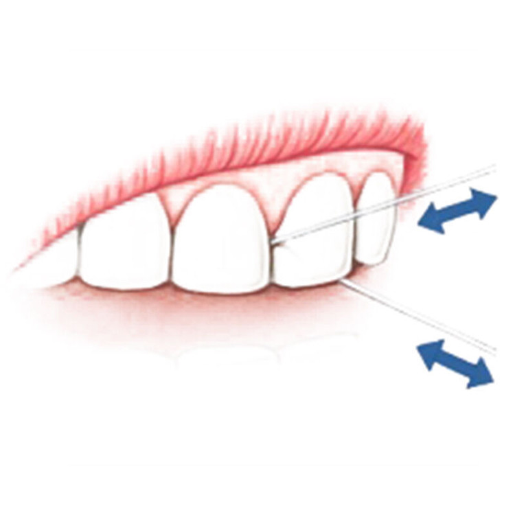 3M 牙线棒 牙齿牙缝护理清洁 细滑牙线（36+4支装）4包组合装