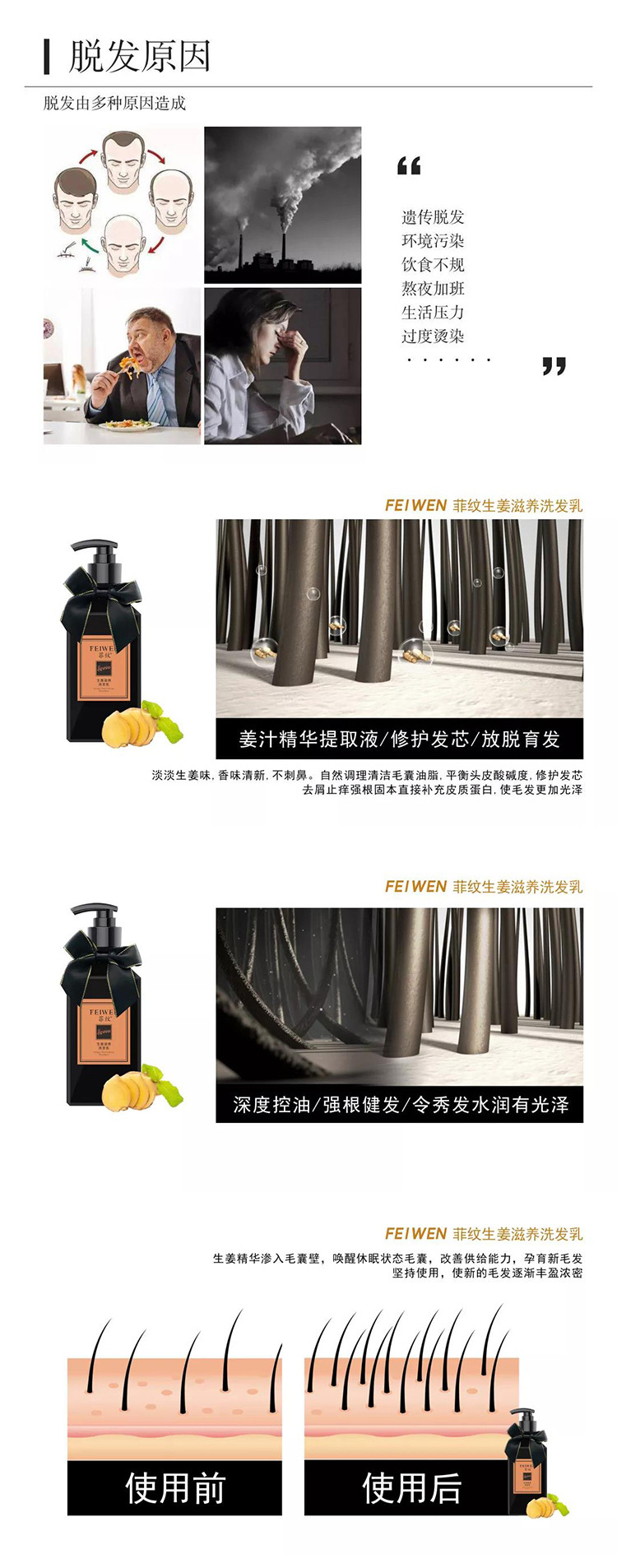 菲纹 洗发水400ml 控油去屑止痒蓬松持久生姜防脱洗发露洗发乳