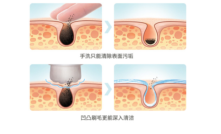 美克斯 电动洁面仪美容仪器 家用洗脸机毛孔清洁器 去油黑头 洗脸神器V脸提升NV8268 升级版