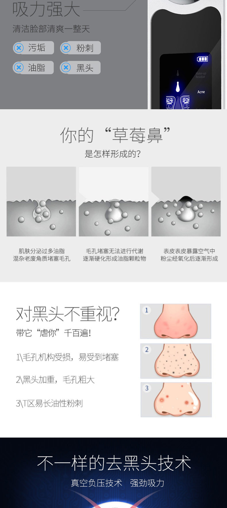 美克斯（MKS）美容仪吸黑头神器去粉刺电动黑头仪洁面仪 NV8530