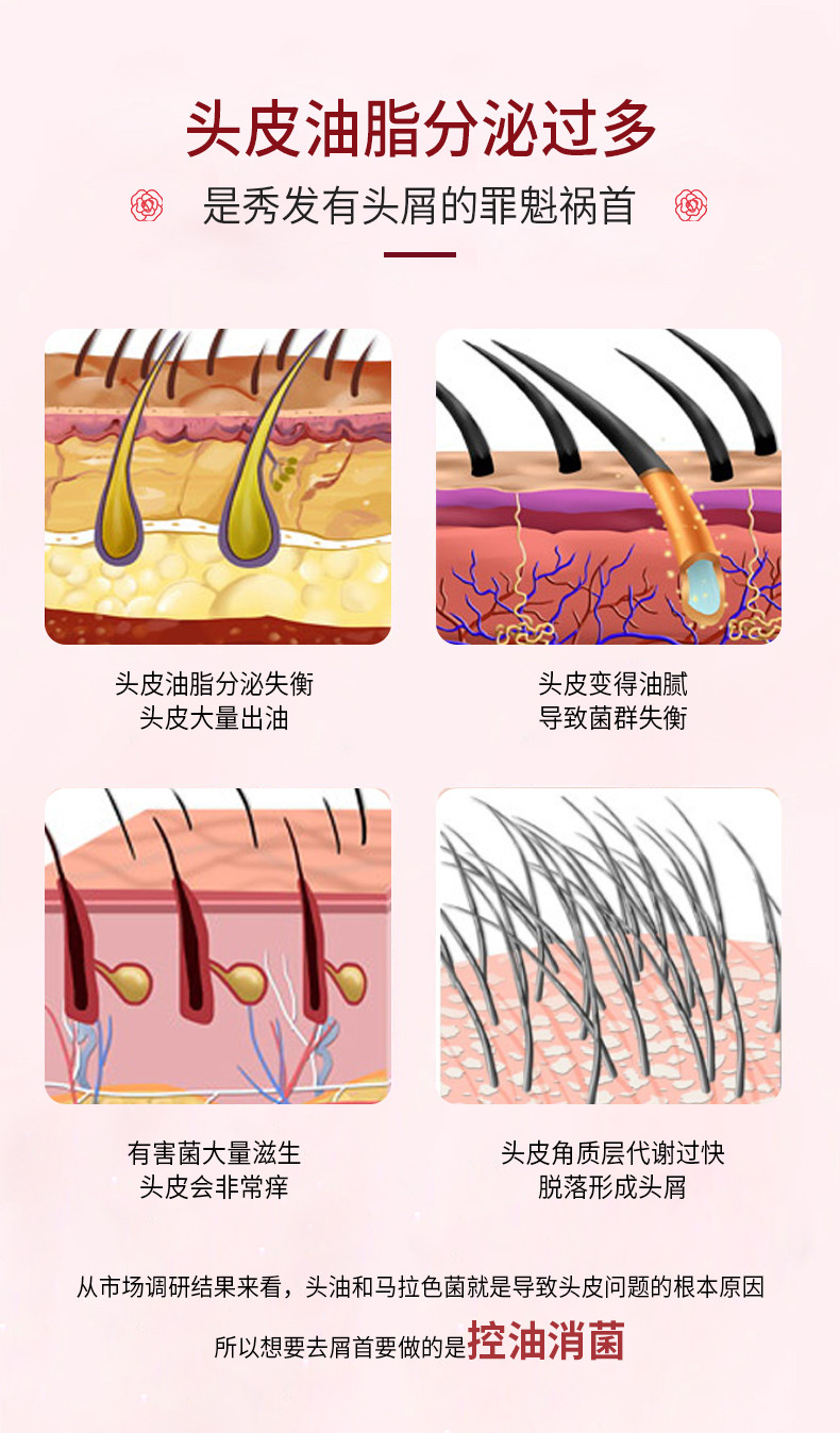 蜜斯莉 Miss Lilly去屑清爽洗发水468gA17