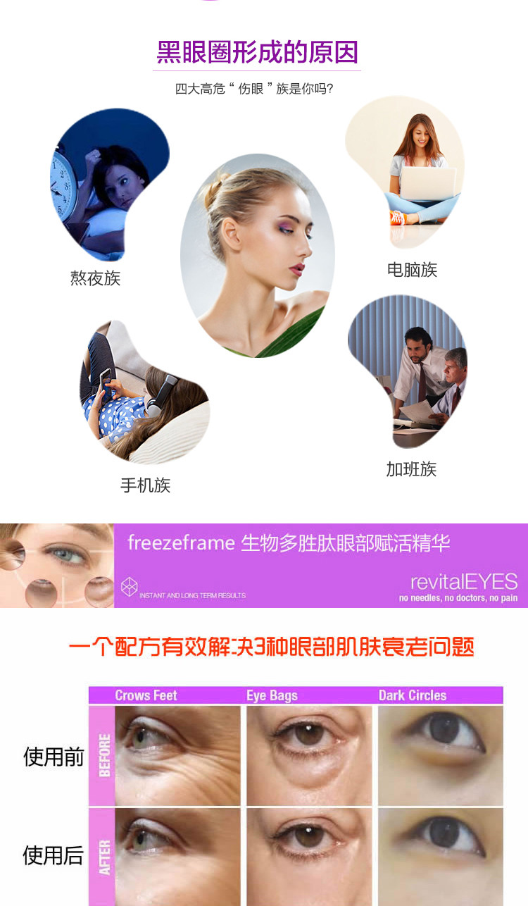 Freezeframe眼霜 15ml 祛皱纹眼袋黑眼圈精华【新包装】