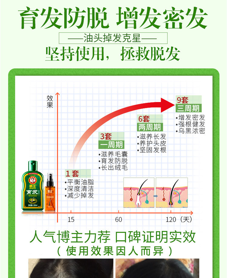 霸王 育发防脱洗发生发液套装 生姜洗发水 防脱发增发密发洗发液200ml 头皮营养育发液55ml