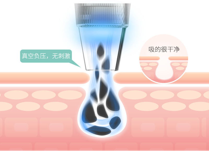 MKS/美克斯 吸黑头仪器电动毛孔清洁器去粉刺神器导出美容仪洁面仪NV8531A