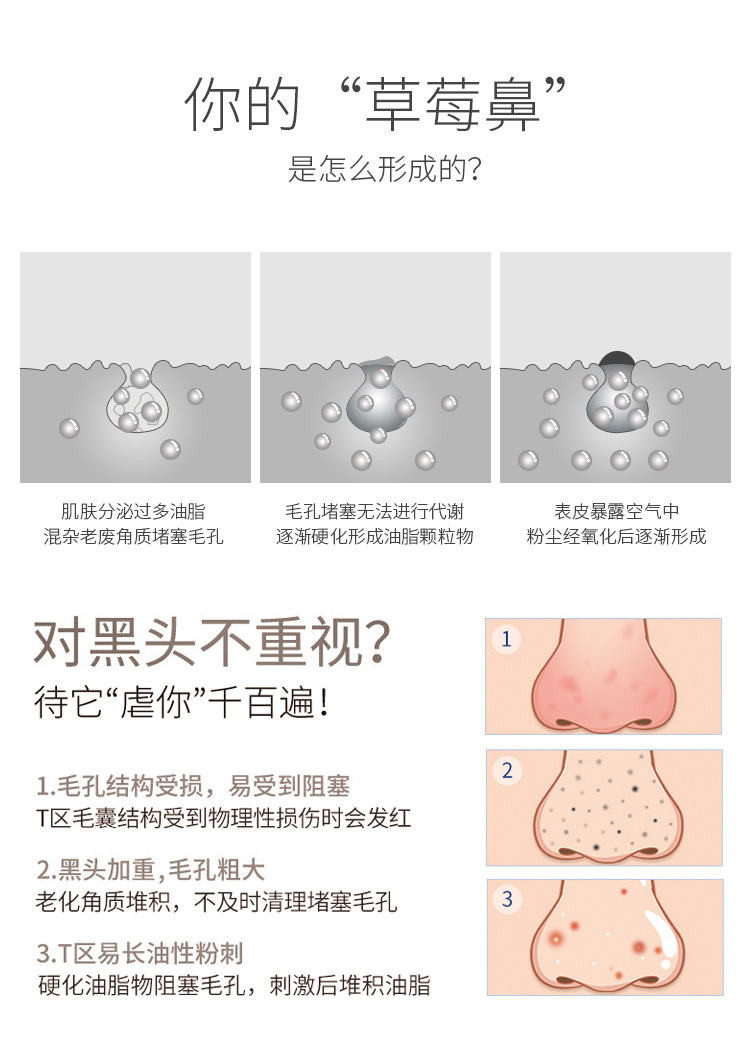 欧卡姿OKACHI 智能真空吸黑头仪 OK-5625 白色