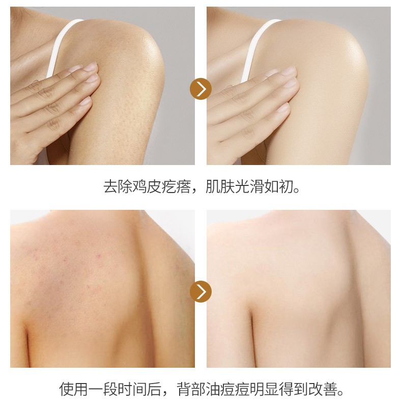 欧丽源澄糖身体磨砂膏去角质改善鸡皮肤疙瘩毛囊C01.OLY-0216
