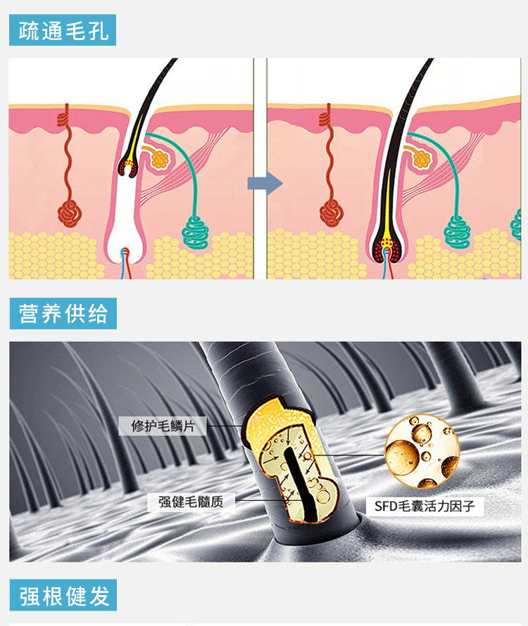 隆力奇蛇胆清爽洗发水1L 控油止痒家庭装