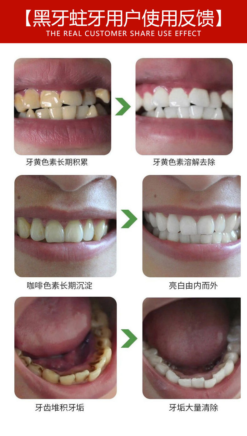 肌肤之食 美齿清新洁牙慕斯口腔清新护理液