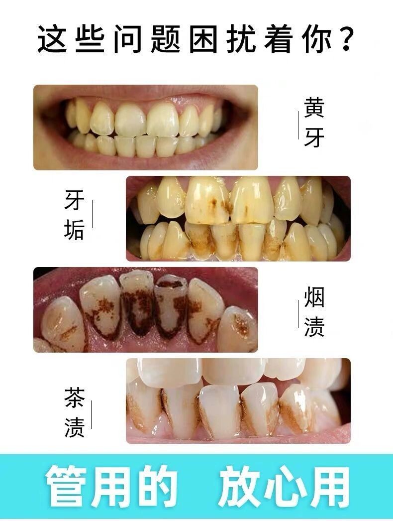 抖音同款网红牙膏椰子壳竹炭牙膏去黄牙垢亮白活性去口臭美白牙膏