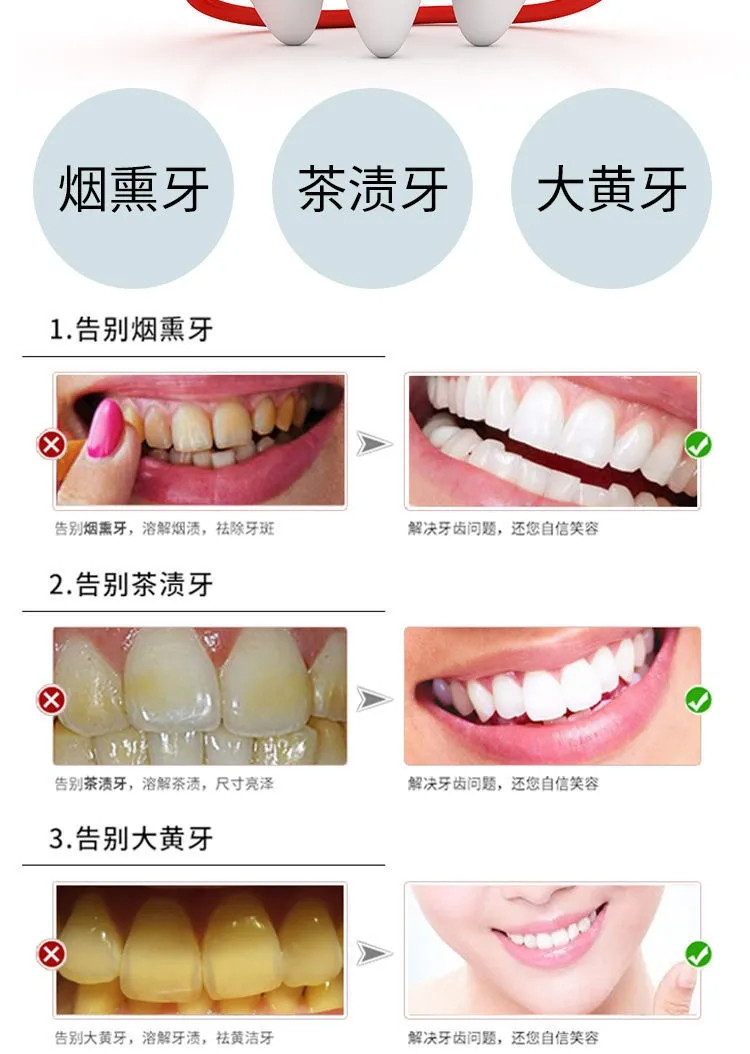 碧缇福美牙仪牙齿美白仪洁牙器去黄牙洗牙神器白牙神器去黄牙凝胶