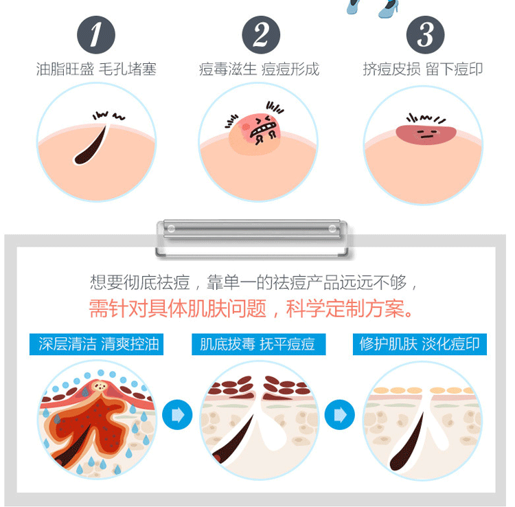 保湿深层补水精华草本祛痘精华液修复痘痘肌20g