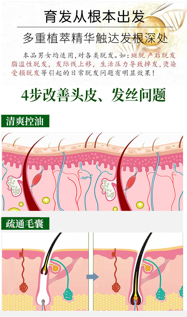 正品老生姜洗发水防脱发生发育发增发密发控油去油去屑姜汁洗发露