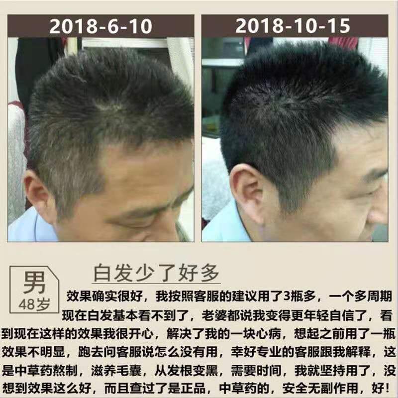 【洗发水】草本养发液老年白遗传性少年白头发自然变黑发洗发露【大牛美妆】