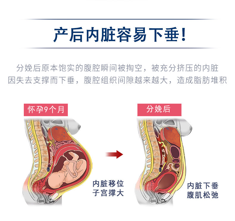 【强力收腹】加强产后收腹带四季款透气孕妇顺产剖腹产纯棉纱布产妇月子束腰带