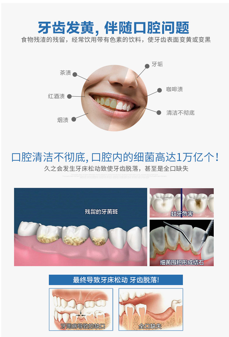 【店铺销售No.3】【邮政助农】浙康酵素小苏打口腔抑菌超强防护美白去黄口臭护龈清新口气牙结石牙膏