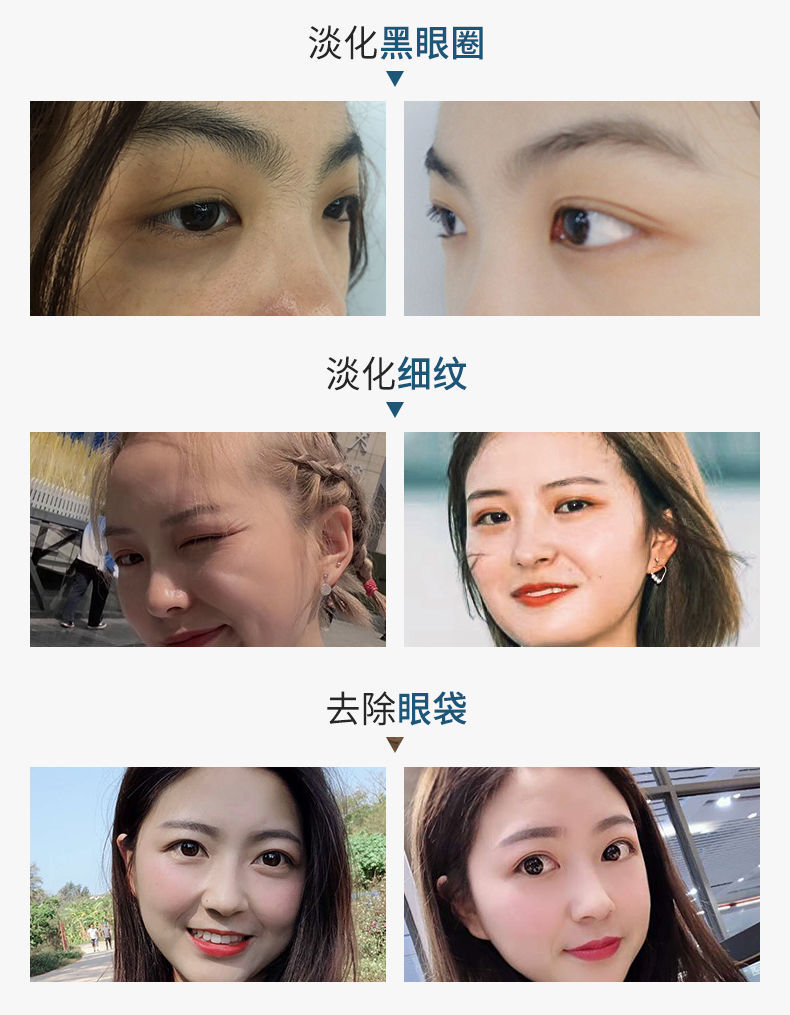 修正眼霜正品去眼袋去皱纹去脂肪粒去黑眼圈保湿抗皱提拉紧致男女