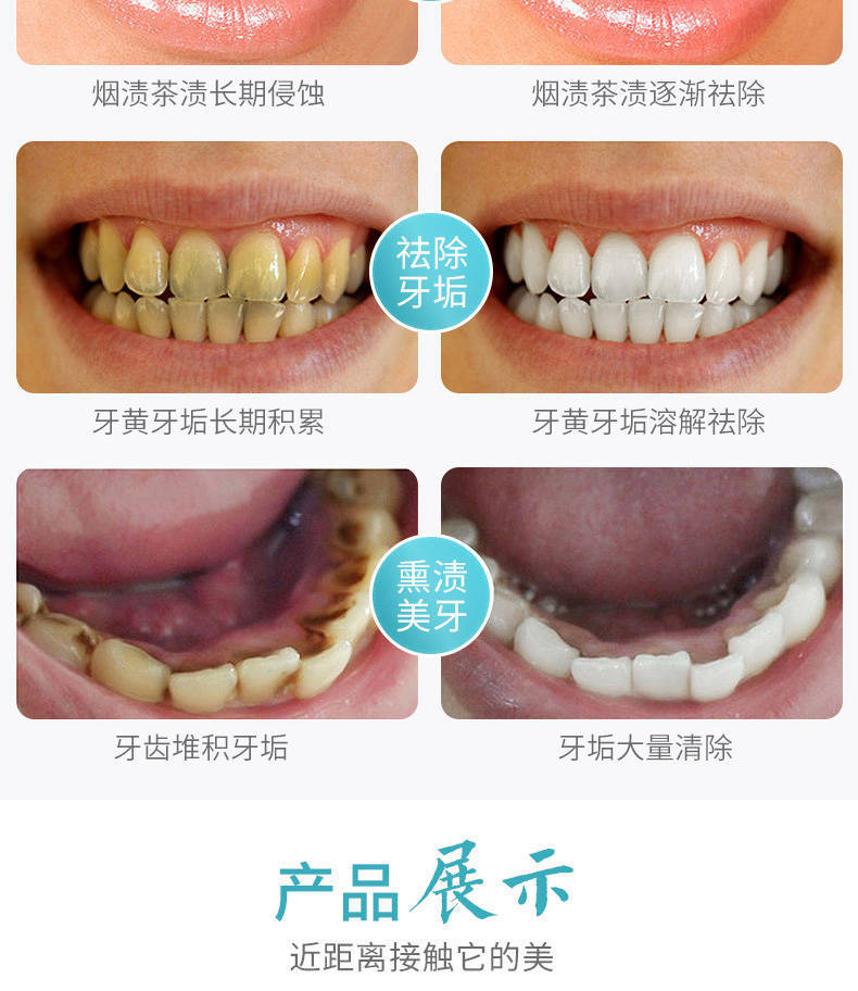 买2送1洁牙慕斯牙膏美白牙齿神器去黄牙结石口臭祛烟渍口气清新